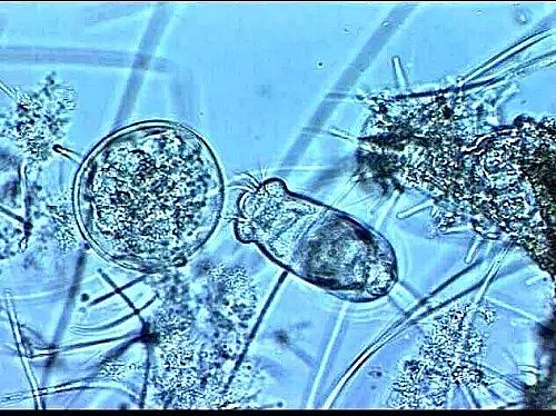 ��x�Ӿ۱�ϩ����CPAM���a(ch��n)�S�ҡ�����������Û���@Щԭ��