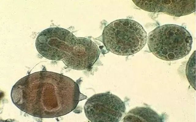 泡沫濾珠濾料EPS廠家工業水處理技術眼花繚亂,拒絕忽悠刻不容緩!