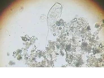 ��(y��u)�|(zh��)�����V�ϏS����ˮ̎��ָʾ��΢�����ȫ!����������