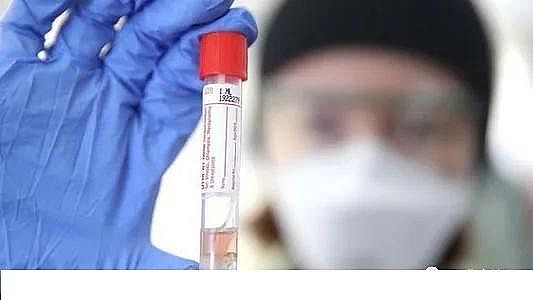 ú�|(zh��)�w������̿0.5-1mm�S�ҰĴ������о��ˆT�_�l(f��)���z�y(c��)��ˮ��Covid-19�����ϵ�y(t��ng)