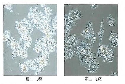 環保粉狀活性炭廠家污水廠應對污泥膨脹的技術管理
