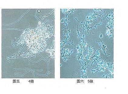 環保粉狀活性炭廠家污水廠應對污泥膨脹的技術管理