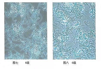 環保粉狀活性炭廠家污水廠應對污泥膨脹的技術管理